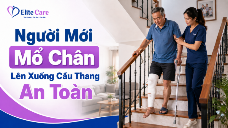 Người Mới Mổ Chân Lên Xuống Cầu Thang An Toàn
